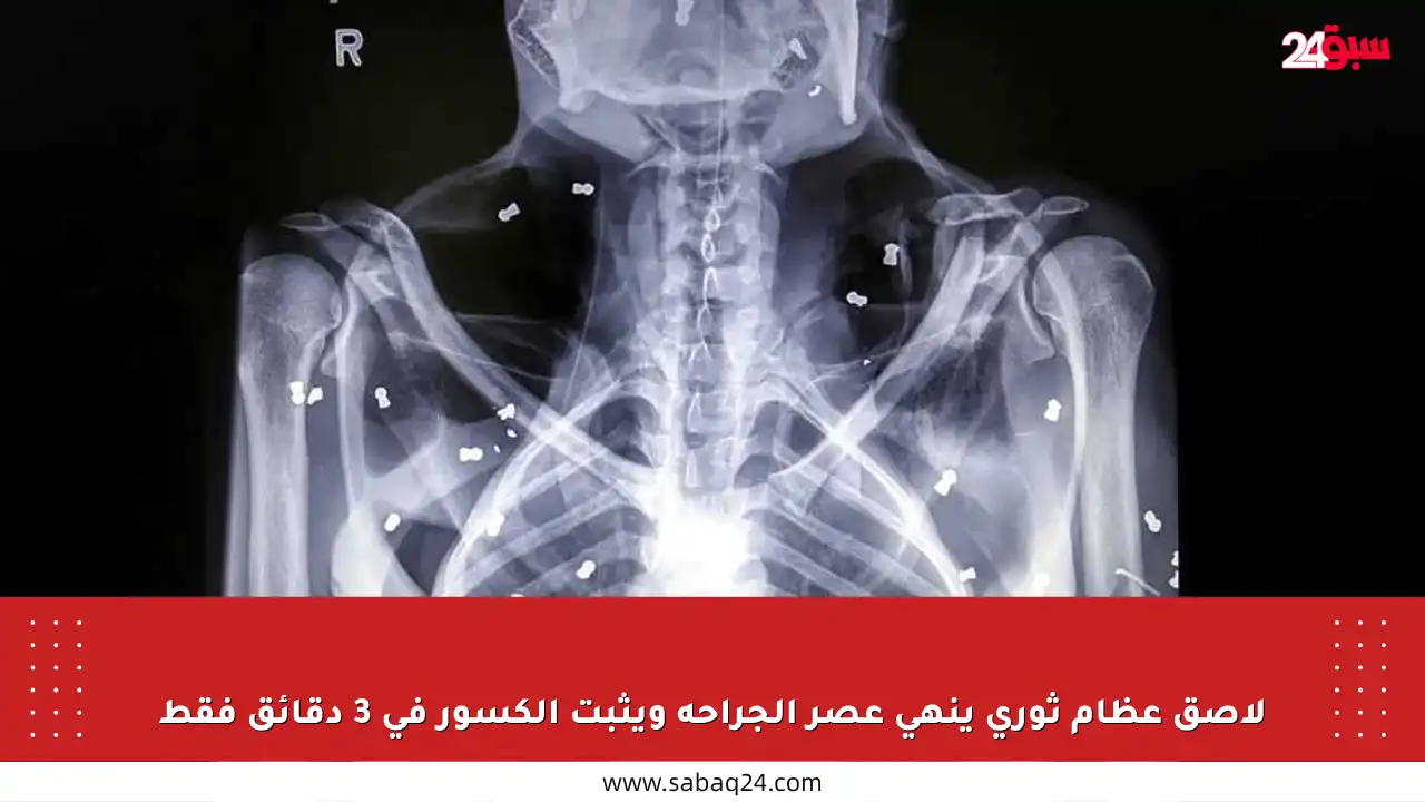 لاصق عظام ثوري ينهي عصر الجراحة ويثبت الكسور في 3 دقائق فقط